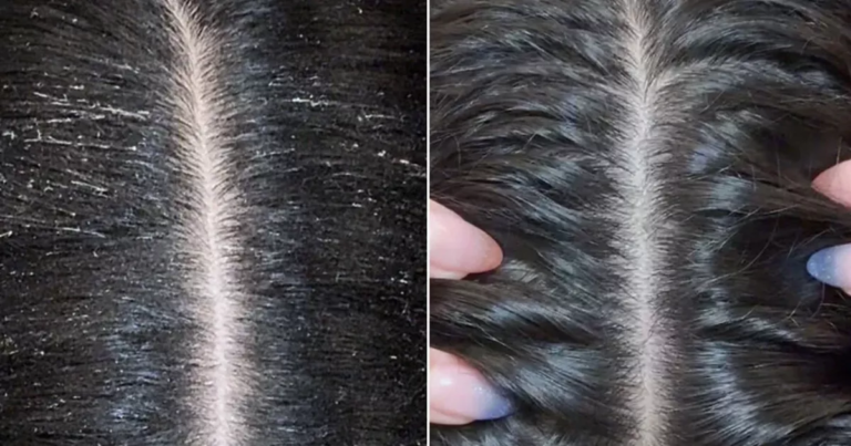 Beauty enthusiasts ditch shampoo for ‘heavenly’ treatment, hailing it as ‘magic’ for those with dry hair