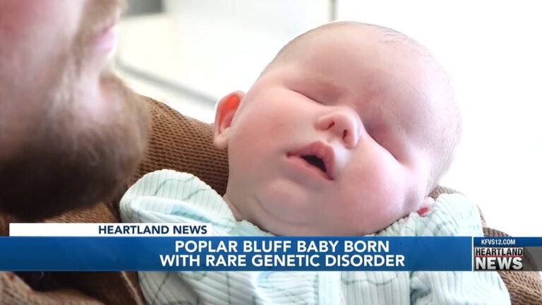 The infant has a rare genetic disease known to affect only 30 people worldwide.