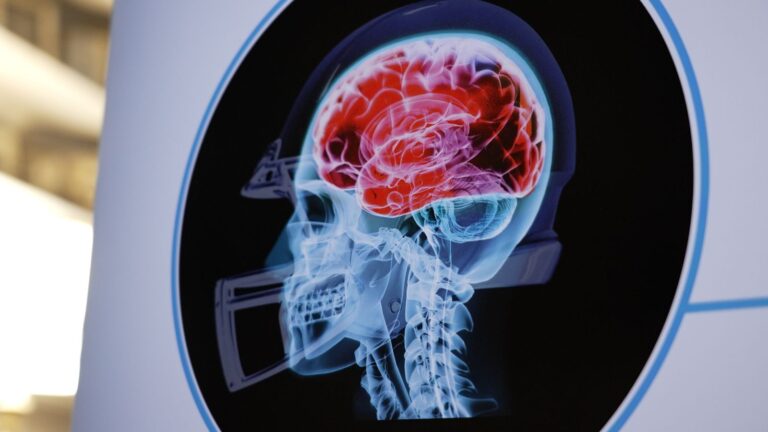 The human toll of brain disease affecting one of the world’s most popular sports | US News