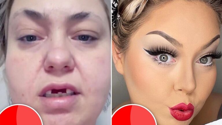 The real cost behind TikTok beauty influencers’ procedures and the impact on beauty standards