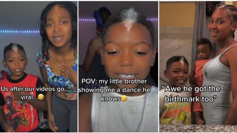 Nigerian woman embraces her beauty despite being bullied for her unique birthmark