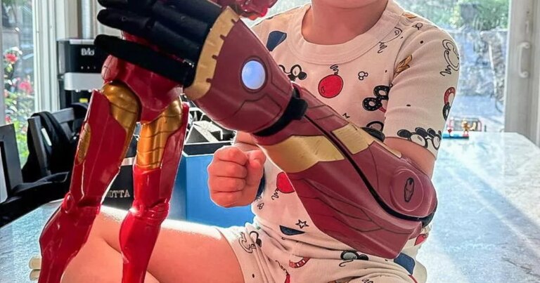 Five-year-old boy becomes youngest person in the world to receive futuristic bionic limbs